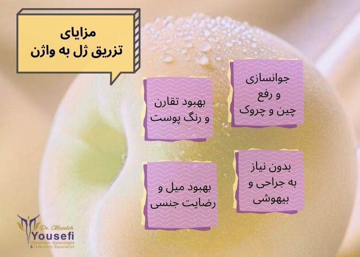 مزایای تزریق ژل به واژن