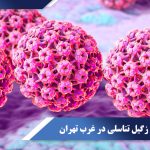 درمان زگیل تناسلی در غرب تهران