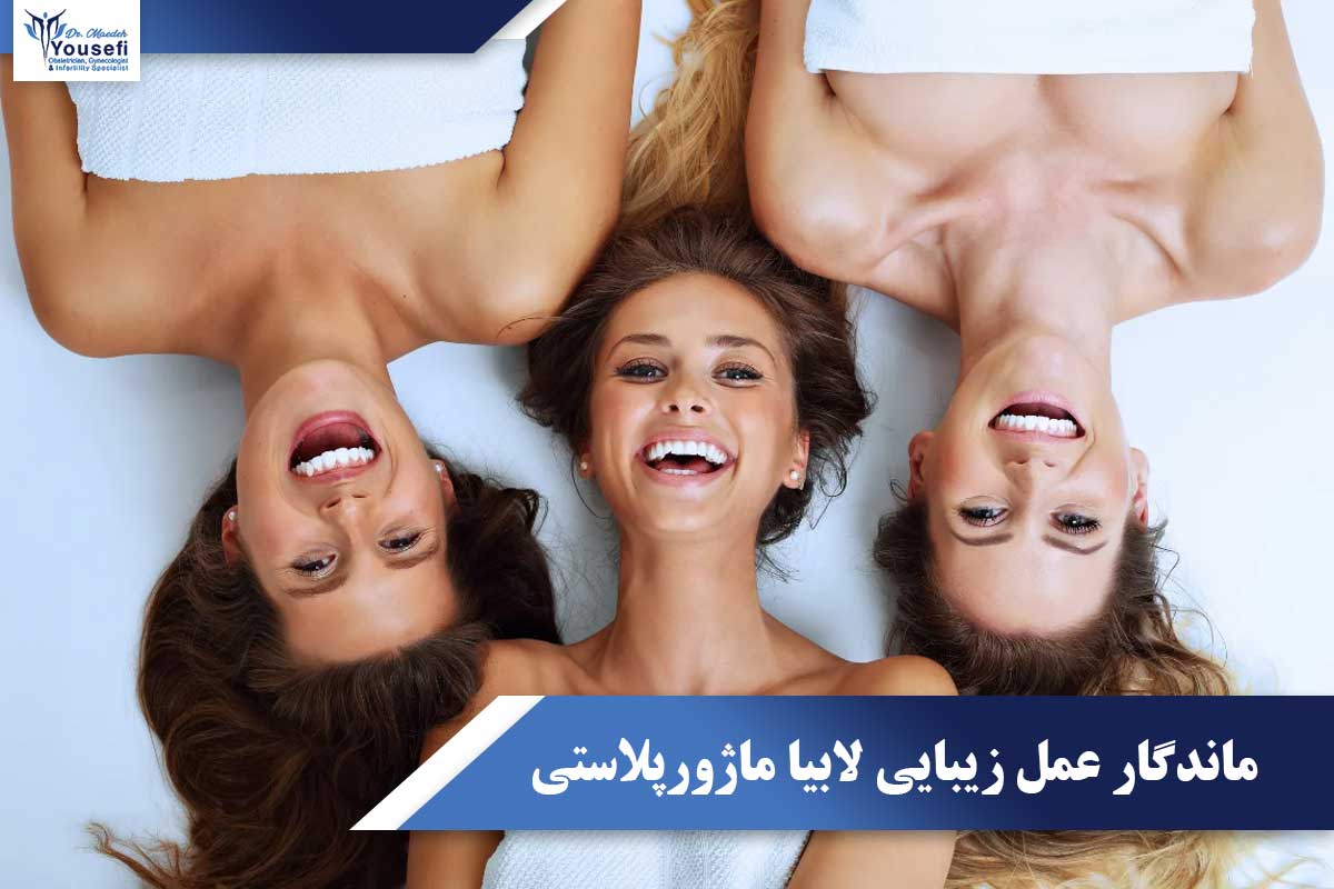 ماندگاری نتایج عمل زیبایی لابیا ماژورپلاستی