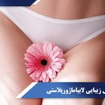 لابیاماژورپلاستی
