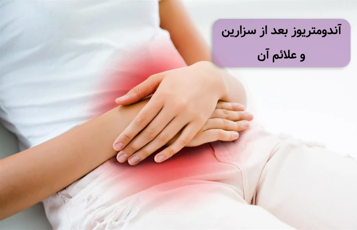 اندومتریوز بعد از سزارین