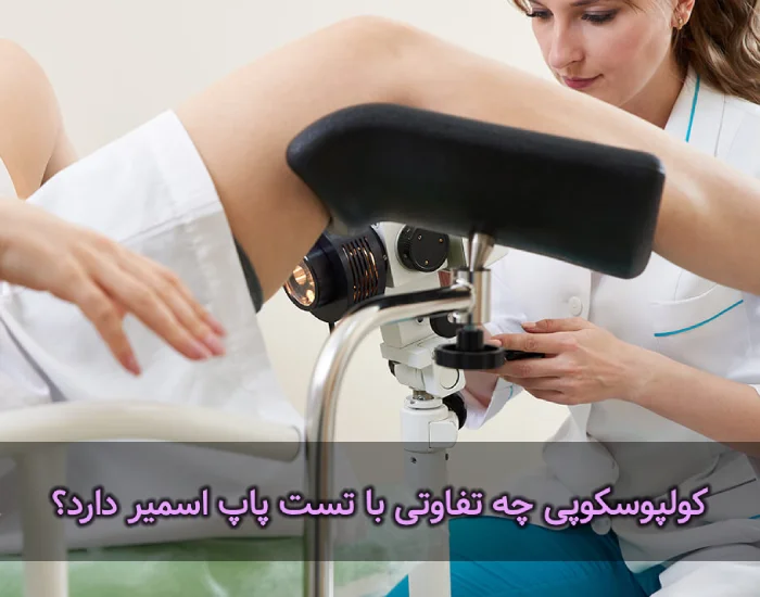 فرق کولپوسکوپی با تست پاپ اسمیر